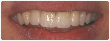 Frsno Dentist Treatments